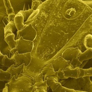 Lyme's Disease: Symptoms, History, Treatments, and the Potential of Poly MVA