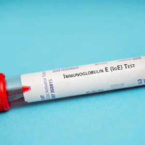 Comprehensive Metabolic Panel: A Component of Blood Tests