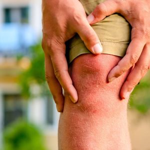 Discover the Power of Natural Remedies for Arthritis Relief