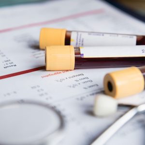 Nutritional Deficiency Blood Chemistry Analysis vs. Conventional Blood Testing