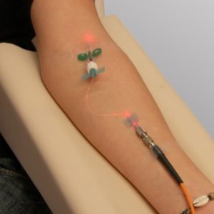 Shedding Light on the Healing Powers of Intravenous Laser Therapy