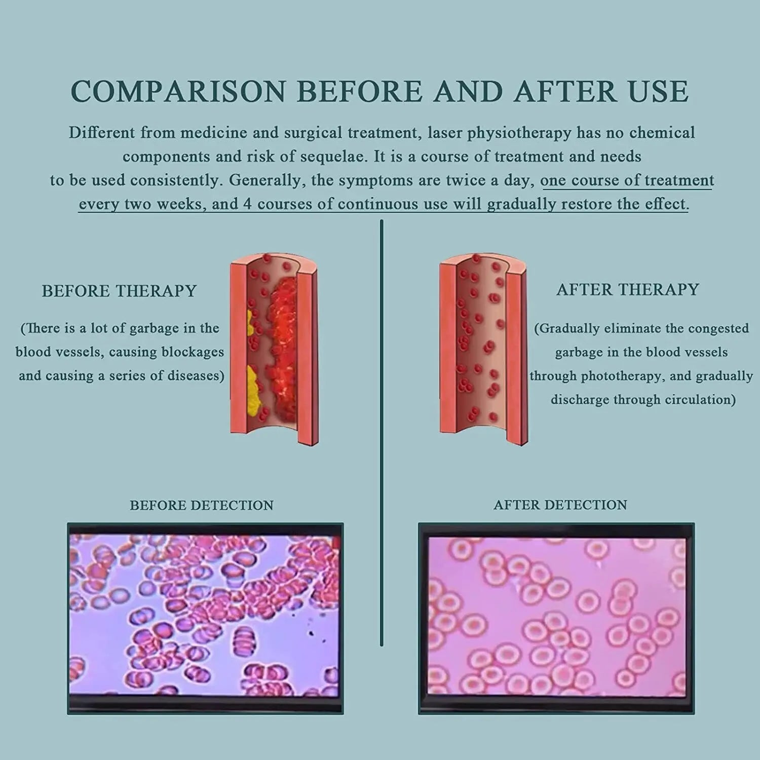 Mitochondrial Activation Laser Wrist Device